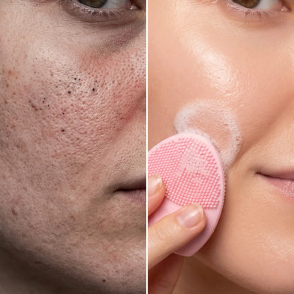 SUMI Face Pad — Japoński Pad Głęboko Oczyszczający